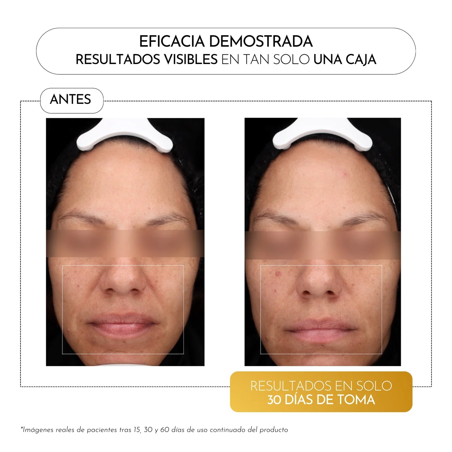 LUXMETIQUE HYALGOLD DAY 15 VIALES
