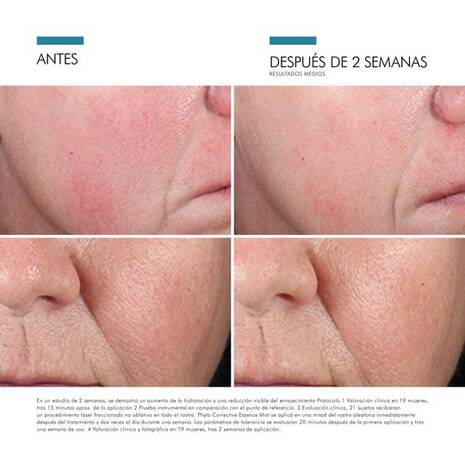 Phyto Corrective Essence Mist Skinceuticals