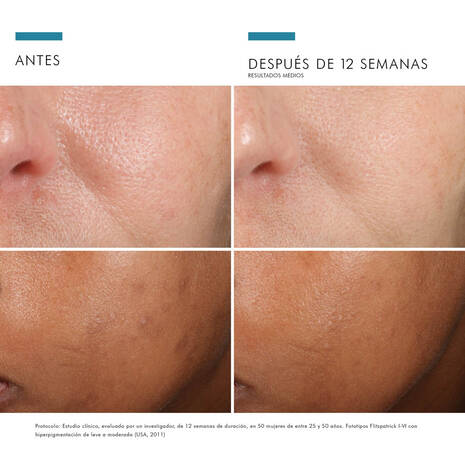 Phloretin CF Vit C Skinceuticals