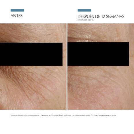 A.G.E. Eye Advanced Complex de Skinceuticals